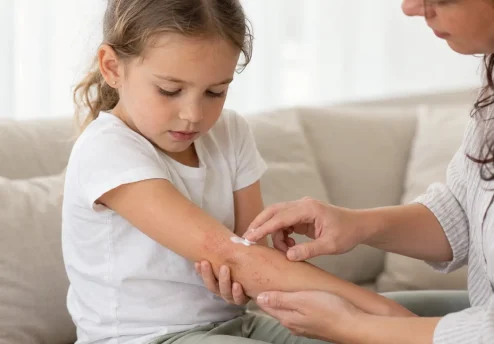 Otrok z atopijskim dermatitisom na roki med nanosom negovalne kreme
