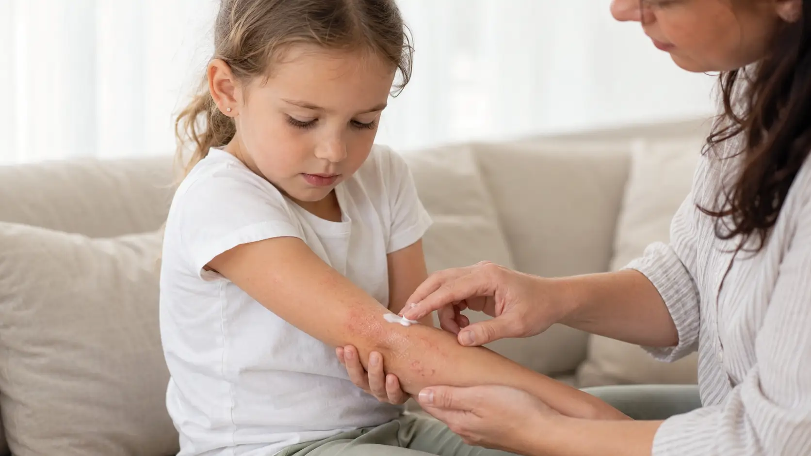 Otrok z atopijskim dermatitisom na roki med nanosom negovalne kreme