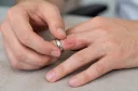 Bližnji posnetek moških rok na mizi. Prstanec nosi srebrn prstan, pod katerim je koža pordela in vneta, kar kaže na kontaktni dermatitis.
