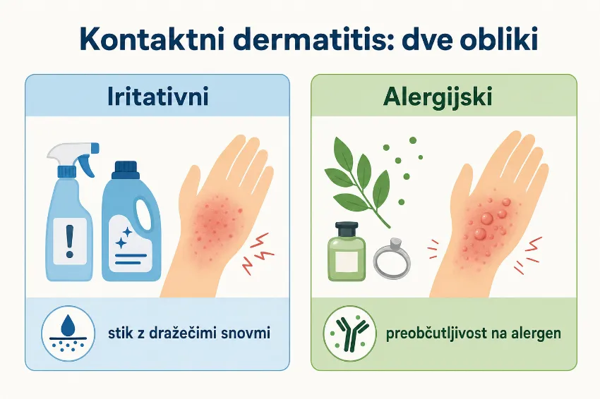 Infografika iritativni in alergijski kontaktni dermatitis
