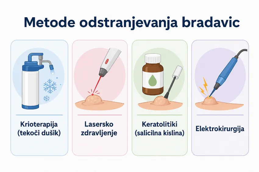 Infografika metode odstranjevanja virusnih bradavic